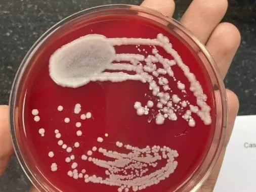 Universities Offering Microbiology